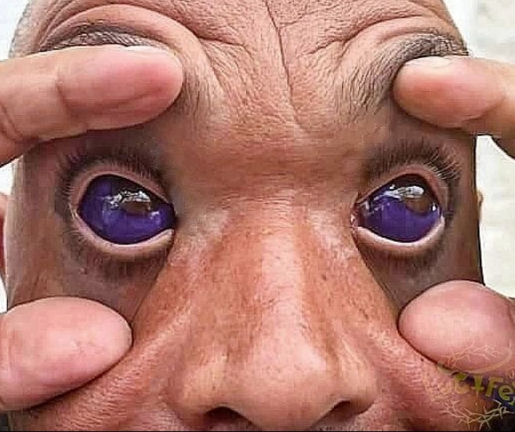 Purple eyeballstattoo