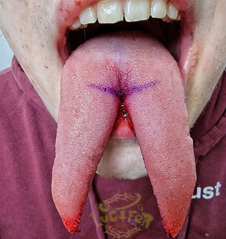 Tongue split modification