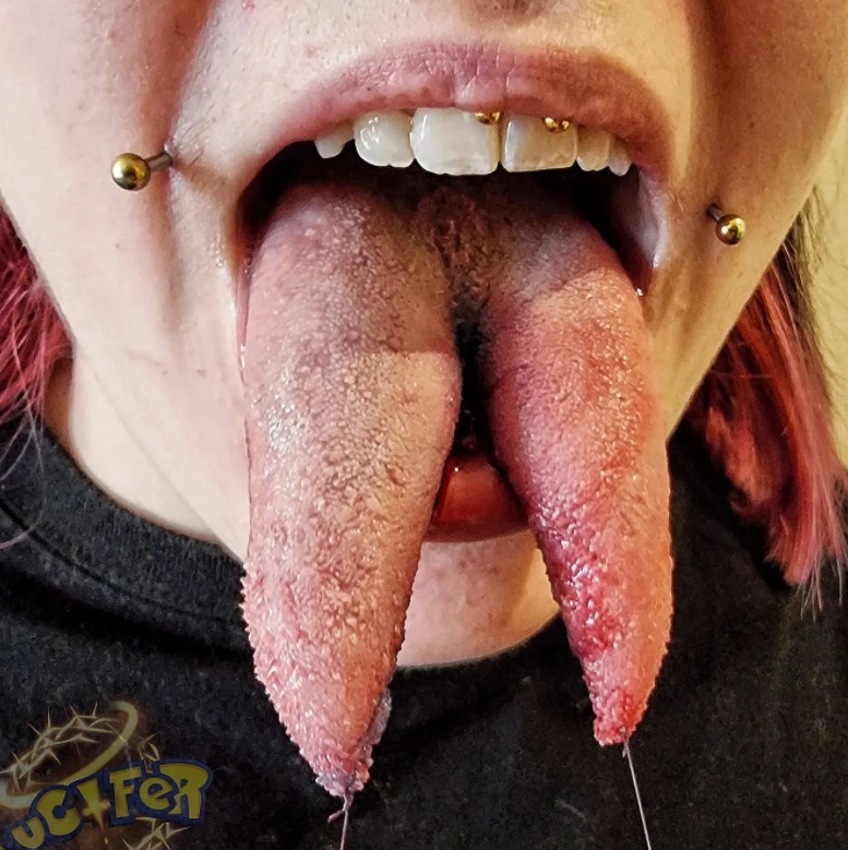 Tongue split